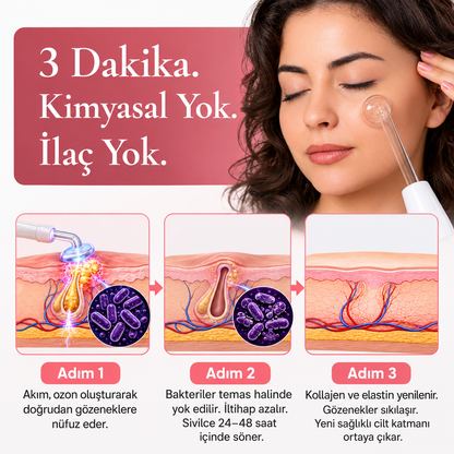 BeautyPro 2.0 Yüksek Frekans Cilt ve Saç Bakım Cihazı