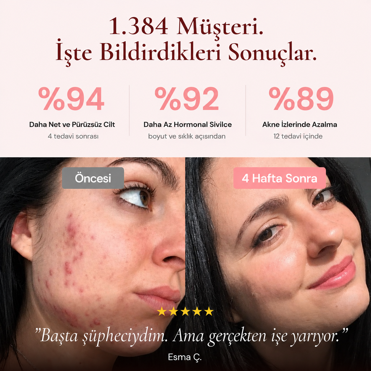 BeautyPro 2.0 Yüksek Frekans Cilt ve Saç Bakım Cihazı