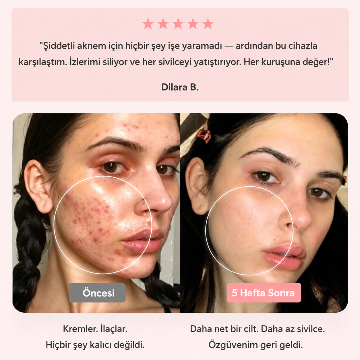 BeautyPro 2.0 Yüksek Frekans Cilt ve Saç Bakım Cihazı
