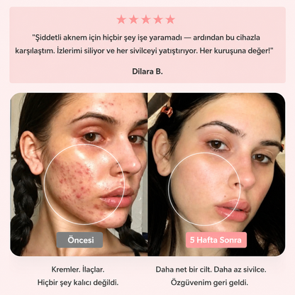 BeautyPro 2.0 Yüksek Frekans Cilt ve Saç Bakım Cihazı
