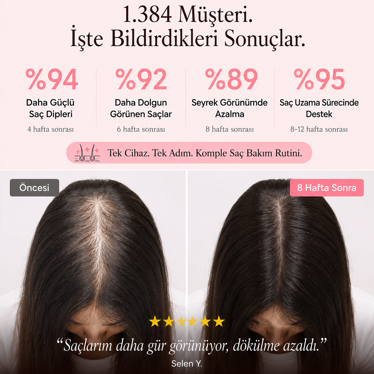 BeautyPro 2.0 Yüksek Frekans Cilt ve Saç Bakım Cihazı